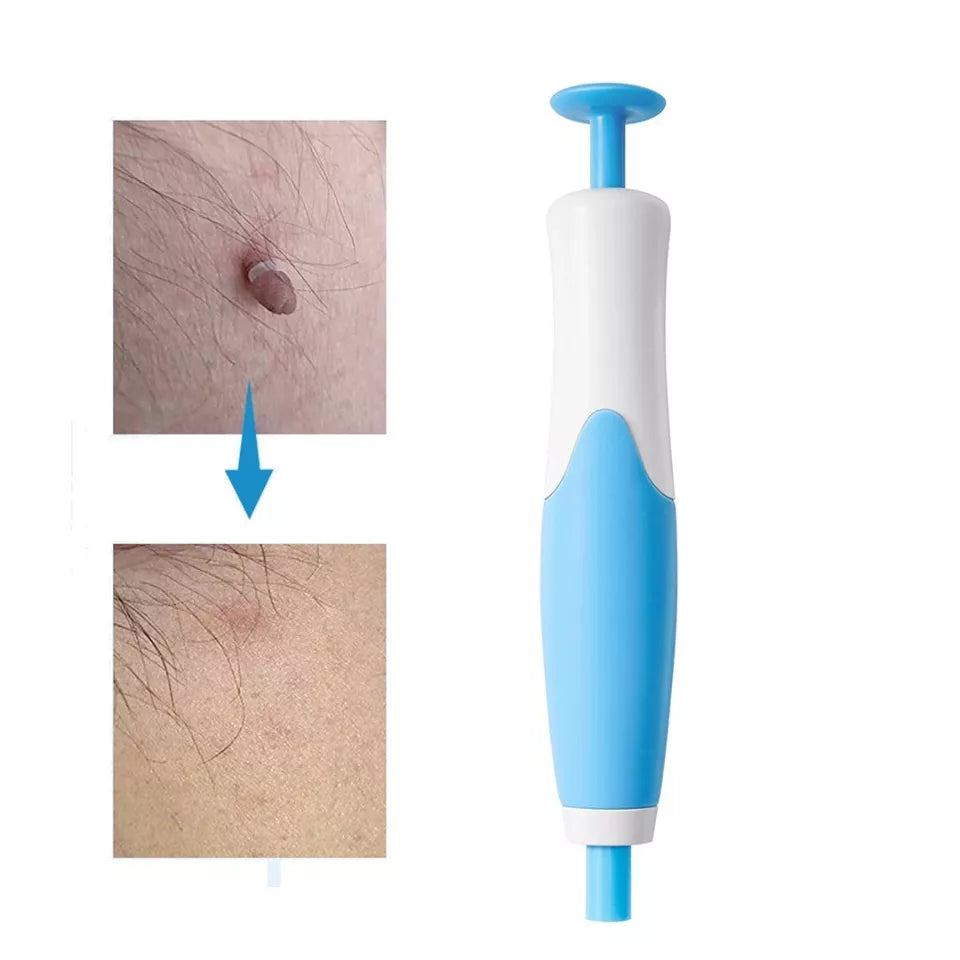 EPICLEAR™ | Wave Away Skin Imperfections