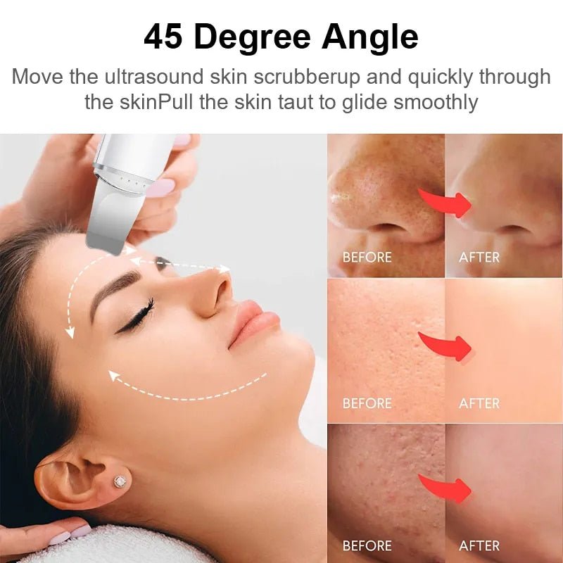 DERMALESSE™ | Unlock your skin's natural glow