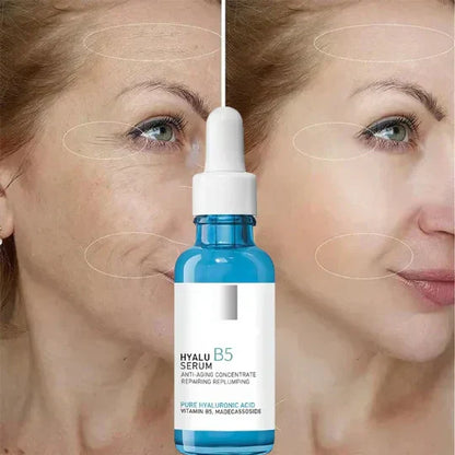 HyaluSerum™ B5 | Resist Aging with Drops